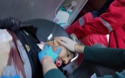 مواطن أصيب برصاص الاحتلال في يعبد بمدينة جنين