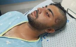 الاحتلال يفرج عن صياد مصاب من قطاع غزة