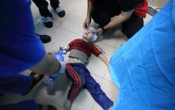 وزارة الصحة تعلن انهيار المنظومة الصحية في غزة