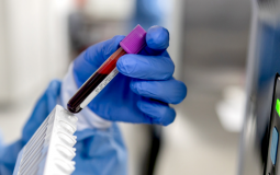 صحة غزة تناشد بضرورة التوجه العاجل للتبرع بالدم