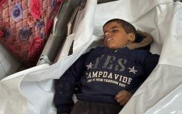 استشهاد 3 صحفيين وارتفاع حصيلة شهداء غزة إلى 11 اليوم