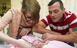 86ولادة طفلة  بريطانية بقلب خارج القفص الصدري
