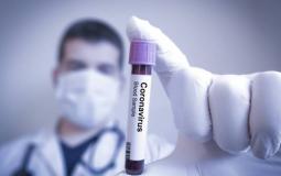 دراسة تكشف أعراضًا جديدة للإصابة بفيروس كورونا