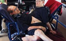 وفاة روني ودوني أطول توأم ملتصق عمرًا حول العالم