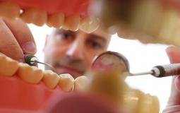حشوة الاسنان المضار والفوائد