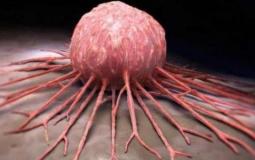 خلايا سرطانية - توضيحية