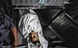 أحد شهداء أمس