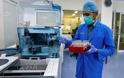 كورونا حول العالم