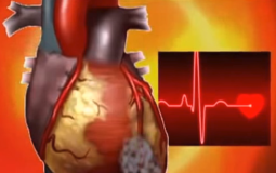 علماء يستخدمون الليزر للتحكم بنبضات القلب