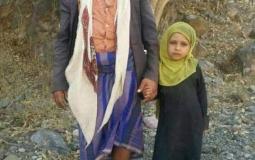 الفتاة المعروضة للبيع في اليمن 