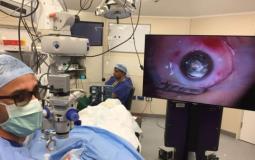 طبيب عيون -صورة تعبيرية-