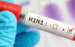 فيروس انفلونزا الخنازير