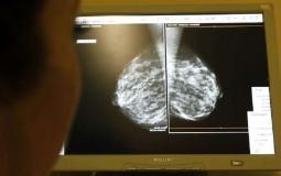 بذرة مغناطيسية تنهي الحاجة لجراحة لجراحة سرطان الثدي