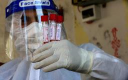 طبيب في غزة يحمل عينات فيروس كورونا
