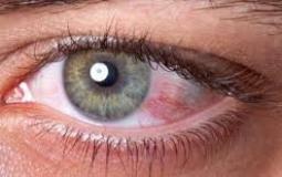 اكتشاف يعالج أخطر أمراض العينين
