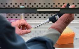 تحذير من خطر وبائي جديد شبيه بفيروس كورونا