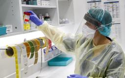 أكسفورد : التجارب الأولية للقاح فيروس كورونا مبشرة