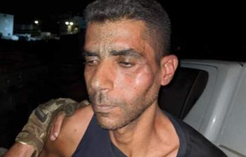 صورة تظهر اعتداء الاحتلال على زكريا الزبيدي