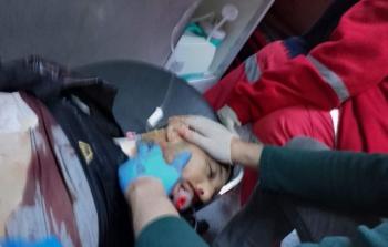 مواطن أصيب برصاص الاحتلال في يعبد بمدينة جنين