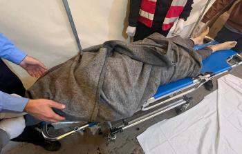 غزة - 73 شهيدا وصولوا مستشفى شهداء الأقصى في 24 ساعة