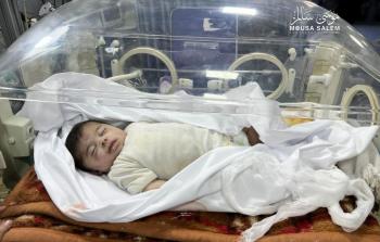 ارتفاع حصيلة شهداء المجاعة بين الأطفال في غزة