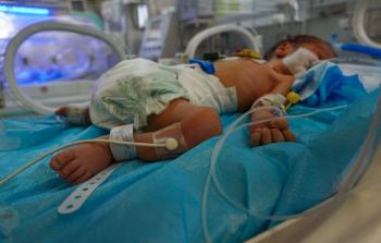 سوء التغذية في غزة خطر على حديثي الولادة