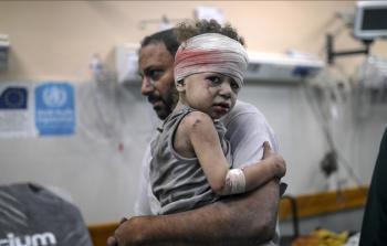 طفل مصاب من الحرب على غزة - تعبيرية