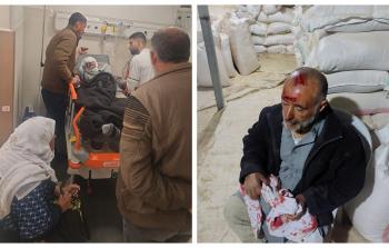 إصابة مواطن في هجوم للمستوطنين جنوب الخليل