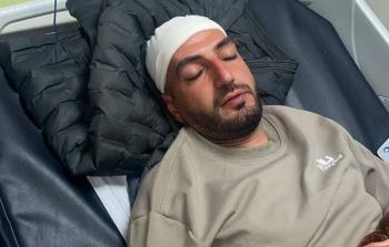 الاحتلال يصيب شابا بقنبلة غاز في رأسه بالقدس