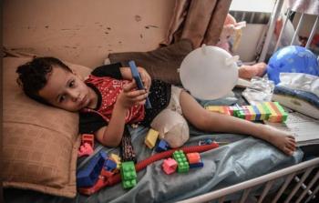 طفولة مبتورة وأحلام باقية: أحمد شاهد على جراح أطفال غزة
