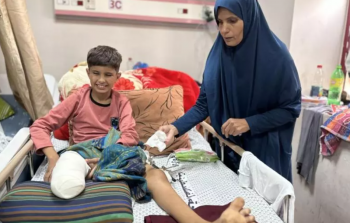 طفل من غزة مصاب ببتر في ساقه - تعبيرية