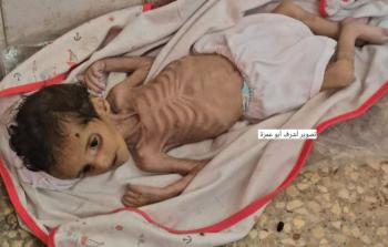 وفاة الطفلة جوري المصري 3 شهور في دير البلح وسط قطاع غزة بسبب سوء التغذية