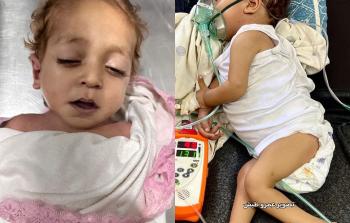 وفاة طفل من قطاع غزة نتيجة حرمانه من العلاج بالخارج