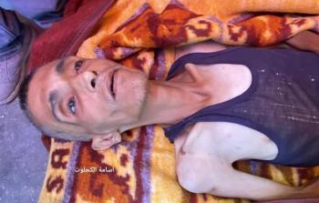 وفاة المواطن أحمد الحسنات نتيجة سوء التغذية في دير البلح