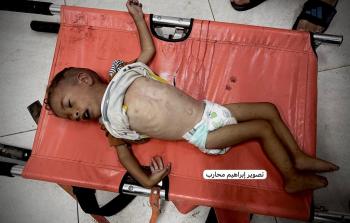غزة - وفاة طفل من سكان خانيونس بسبب التجويع