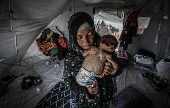 المجاعة في غزة - تعبيرية