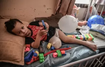 بتر الأطراف لدى الأطفال في غزة