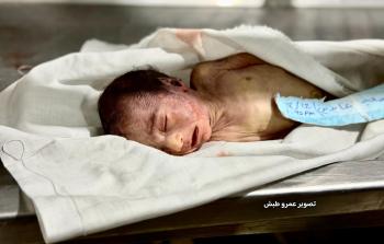 وفاة طفل نتيجة البرد القارس في مواصي خانيونس 