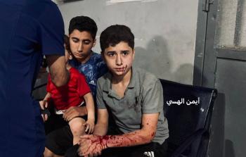 أطفال مصابون جراء القصف الإسرائيلي الليلة على غزة