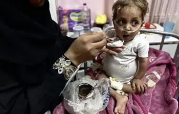التقزّم والهزال يهدّدان أطفال غزة