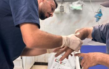 غزة : شهيدان و13 جريحاً بغارة إسرائيلية استهدفت مركبة مدنية