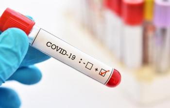 فيروس كورونا - تعبيرية