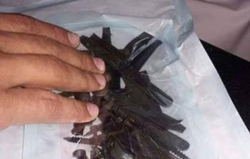  استخراج مسامير وملاعق من معدة مريض في غزة