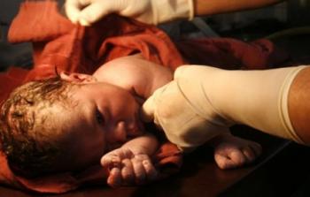 ارتفعت نسب الولادة القيصرية في مصر لتتعدى 52 في المئة، مقارنة بحوالي سبعة في المئة عام 1995