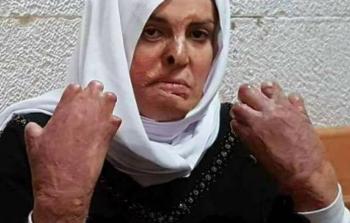  الأسيرة المقدسية إسراء الجعابيص