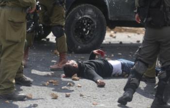 فلسطيني مصاب 