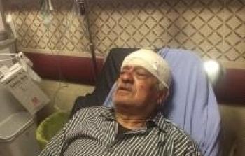 إصابة مسن من قرية برقة بجروح إثر اعتداء المستوطنين عليه