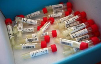 عينات فحص فيروس كورونا - أرشيفية