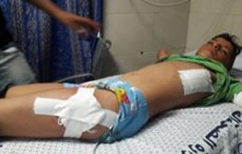 أحد المصابين خلال المباراة