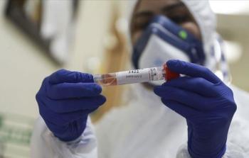 جائحة كورونا في فلسطين تحت السيطرة الكاملة